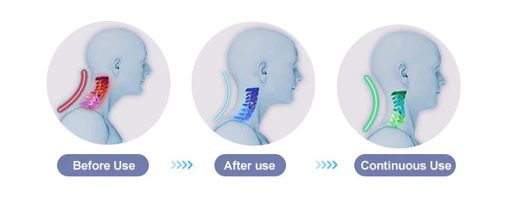 Alphay Medical Masážní přístroj na krk a ramena 4